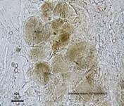 Gelbstieliger Dachpilz, Foto 18
