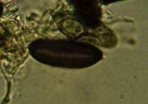 Gewöhnliche Schwarzbrust, Foto 11