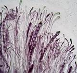 Glattsporiger Amethystbecherling, Foto 7
