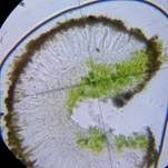 Goldfarbene Dotterflechte, Foto 8
