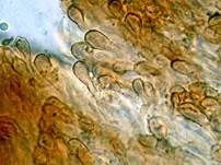 Gras-Stromabecherling, Foto 9