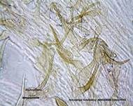 Hornstieliger Schwindling, Foto 18