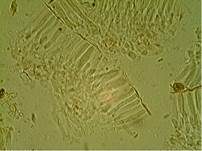 Hyalin-Knopfbecherchen, Foto 10