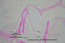Hyazinthenschneckling, Foto 16