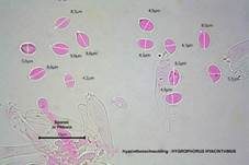 Hyazinthenschneckling, Foto 17
