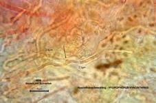 Hyazinthenschneckling, Foto 10
