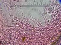 Kaktuskeule, Foto 17