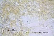 Birkenknäueling, Foto 61
