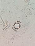 Kleine Becherlorchel, Foto 20