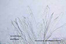 Kronenbecherling, Foto 26