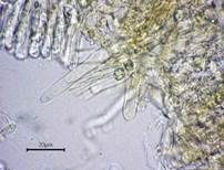 Blasser Adermoosling, Foto 24