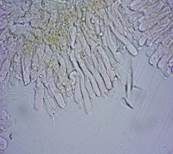 Blasser Adermoosling, Foto 30