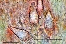 Nadelholz-Zystidenrindenpilz, Foto 31