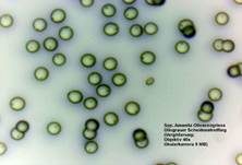 Olivgrauer Scheidenstreifling, Foto 6