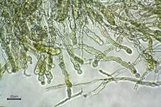 Blasses Hautscheibchen, Foto 18
