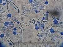 Opalfarbige Wachskruste, Foto 21