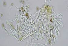 Pilz-Stecknadelflechte, Foto 8
