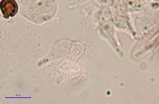 Psilocybin-Trüffel, Foto 18