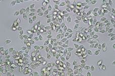 Rhomboidsporiger Flockenschüppling, Foto 14