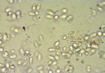 Rillstieliger Weichritterling, Foto 35