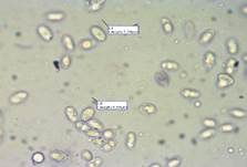 Rillstieliger Weichritterling, Foto 40