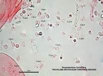 Risspilzähnlicher Erdritterling, Foto 17