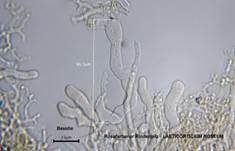 Rosafarbener Rindenpilz, Foto 28