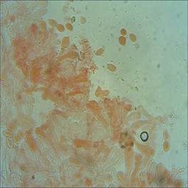 Rosaschimmerndes Fadenkeulchen, Foto 6