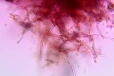 Rotgelber Amyloidsporenrindenpilz, Foto 7
