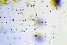 Rotgelber Amyloidsporenrindenpilz, Foto 8