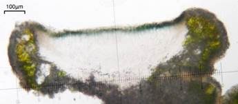 Schwarzbecher Krustenflechte, Foto 6