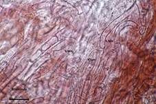 Shiitake, Foto 30