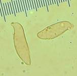 Sibirische Herkuleskeule, Foto 8