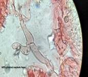 Stachelbeertäubling, Foto 23