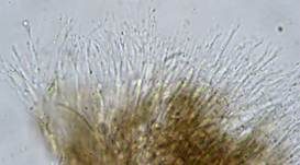 Stacheldung-Schlauchpilz, Foto 10