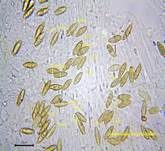Steinpilz, Foto 73