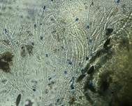 Subiculum-Schwarzbrust, Foto 17