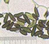 Subiculum-Schwarzbrust, Foto 10