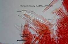 Überhäuteter Häubling, Foto 22
