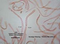 Brandiger Ritterling, Foto 56