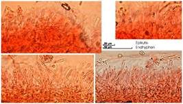 Violetter Reiftäubling, Foto 28
