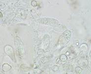Braunblättriger Nabelrötling, Foto 10
