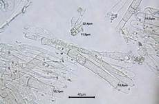 Braune Speisemorchel, Foto 20