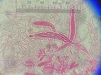 Weißwolliger Kugelpilz, Foto 24