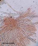 Anemonenbecherling, Foto 40