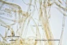 Zuchtchampignon, Foto 20