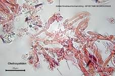 Echter Knoblauchschwindling, Foto 29