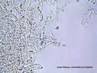 Echter Pfifferling, Foto 35