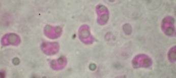 Feinwarziger Flockenschwamm, Foto 7