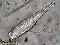 Feinwarziger Zystidenrindenpilz, Foto 14